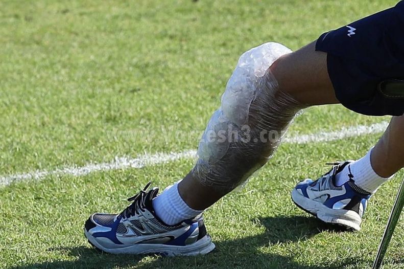 (عکس) وضعیت وخیم زانوی بیرانوند پس از مصدومیت (عکس) وضعیت وخیم زانوی بیرانوند پس از مصدومیت