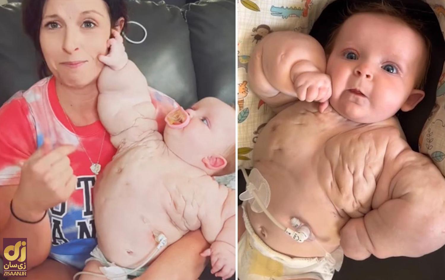 نوزادی  که بدنساز به دنیا آمد! // نوزادی که بدنساز متولد شد!