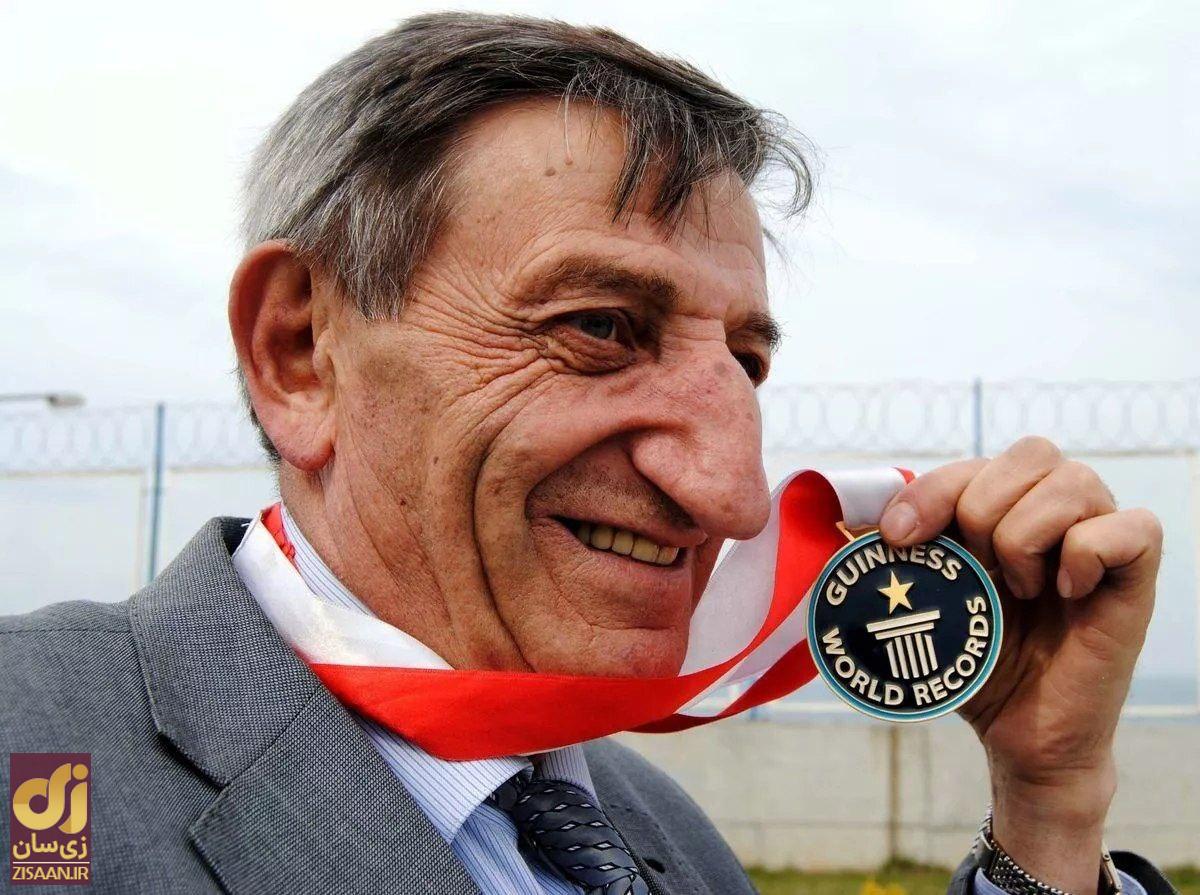 (تصاویر) صاحب بزرگترین دماغ دنیا کیست؟ (تصاویر) صاحب بزرگترین دماغ دنیا کیست؟