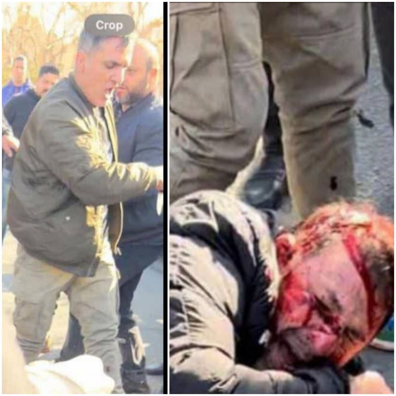 (ویدئو +16) اولین تصاویر از صورت خونی هانی کرده/ فریاد‌های هانی کرده بعد از اثابت گلوله!