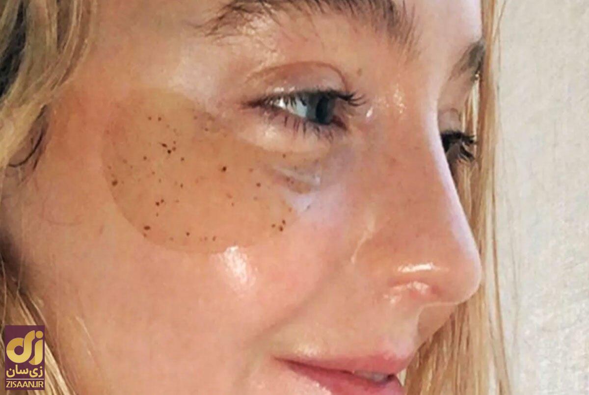 مراقبت از پوست