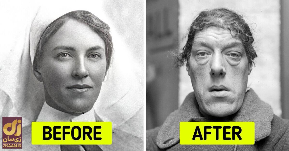 داستان غم انگیز «زشت‌ترین زن جهان»