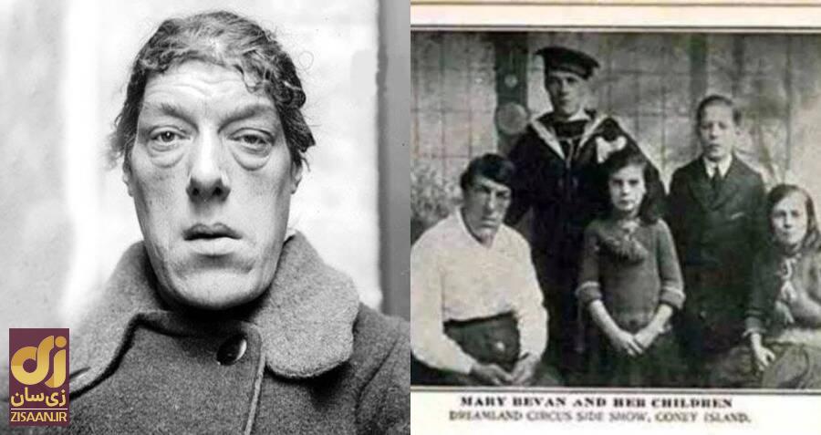 داستان غم انگیز «زشت‌ترین زن جهان»