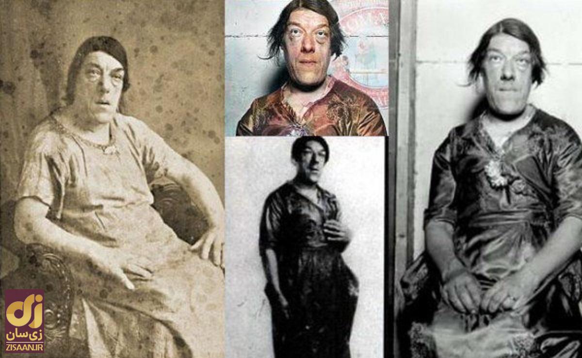 مری «زشت‌ترین زن جهان»