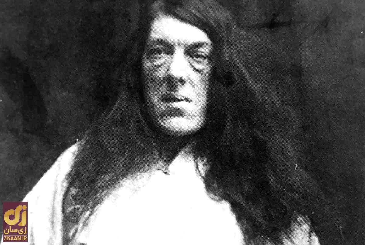 داستان غم انگیز «زشت‌ترین زن جهان»