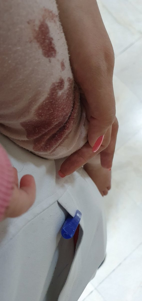 تلخ‌ترین عکسی یک پرستار