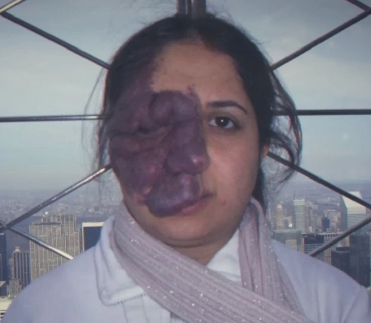 ماجرای زن ایرانی که مردم از خال روی صورتش میترسیدند+ عکس ماجرای زن ایرانی که مردم از خال روی صورتش میترسیدند+ عکس