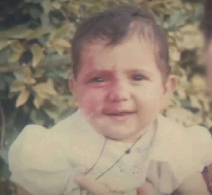 ماجرای زن ایرانی که مردم از خال روی صورتش میترسیدند+ عکس ماجرای زن ایرانی که مردم از خال روی صورتش میترسیدند+ عکس