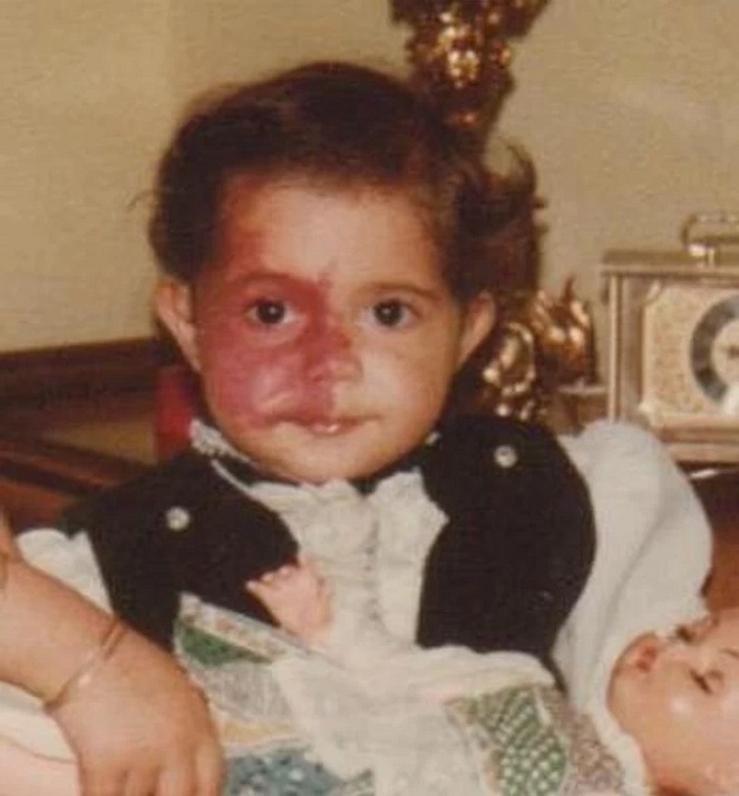 ماجرای زن ایرانی که مردم از خال روی صورتش میترسیدند+ عکس ماجرای زن ایرانی که مردم از خال روی صورتش میترسیدند+ عکس