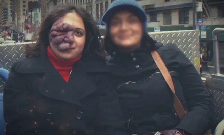 ماجرای زن ایرانی که مردم از خال روی صورتش میترسیدند+ عکس ماجرای زن ایرانی که مردم از خال روی صورتش میترسیدند+ عکس