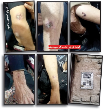 دراکولا در مشهد بازداشت شد؛ قاتلی با دهان خونی که یک محله را به وحشت انداخت!