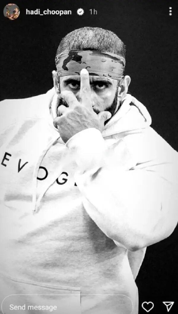 هادی چوپان با این تیپ عجیب غوغا کرد + عکس