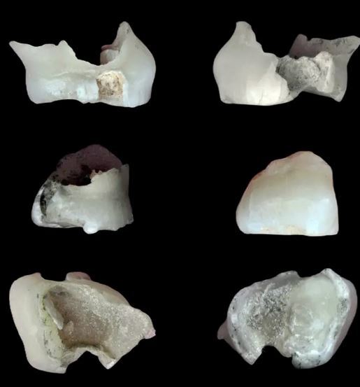 (عکس) کشف قدیمی‌ترین بقایای انسانی در ایران/ دندان ۱۷۵ هزار ساله