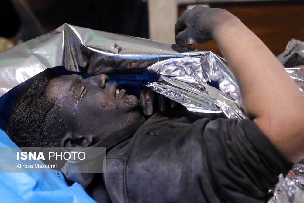 (تصاویر + ۱۸) هشدار: تصاویر ناراحت کننده از مصدمان چهارشنبه سوری (تصاویر + ۱۸) هشدار: تصاویر ناراحت کننده از مصدمان چهارشنبه سوری