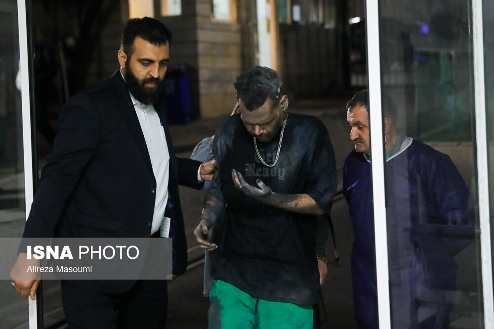 (تصاویر + ۱۸) هشدار: تصاویر ناراحت کننده از مصدمان چهارشنبه سوری (تصاویر + ۱۸) هشدار: تصاویر ناراحت کننده از مصدمان چهارشنبه سوری