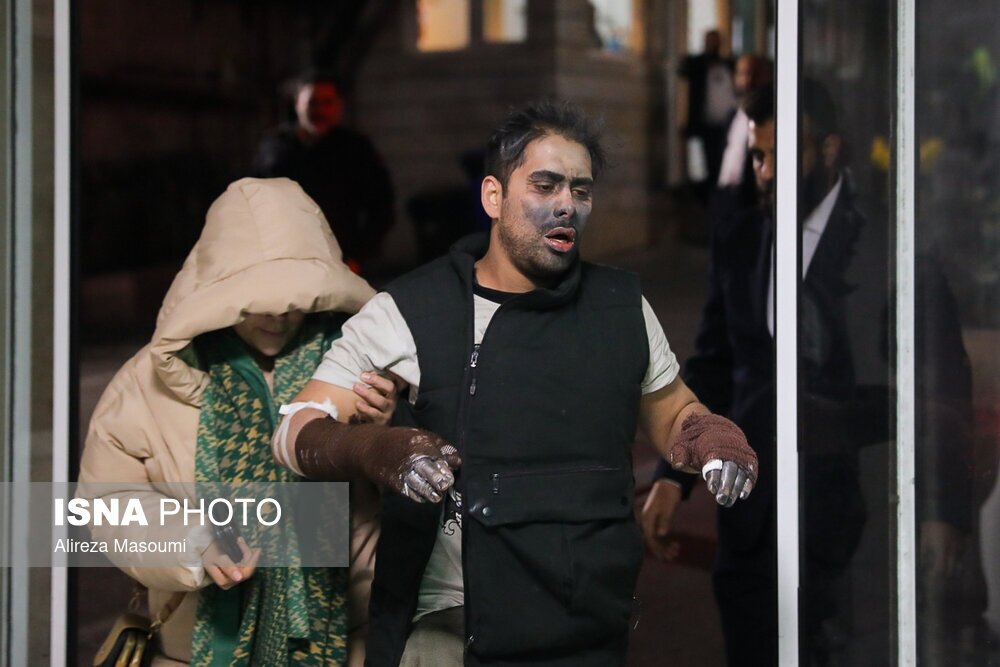 (تصاویر + ۱۸) هشدار: تصاویر ناراحت کننده از مصدمان چهارشنبه سوری (تصاویر + ۱۸) هشدار: تصاویر ناراحت کننده از مصدمان چهارشنبه سوری