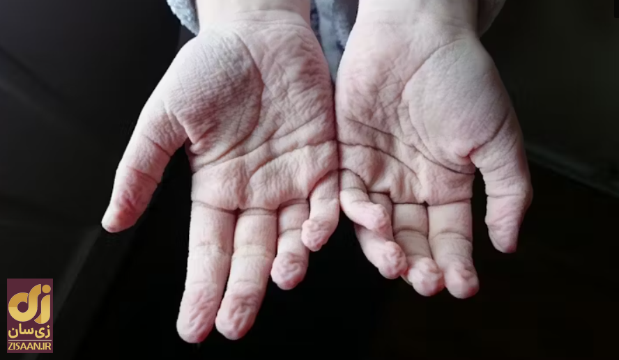 انگشتان پا و انگشتان ما در حمام چروک می شوند