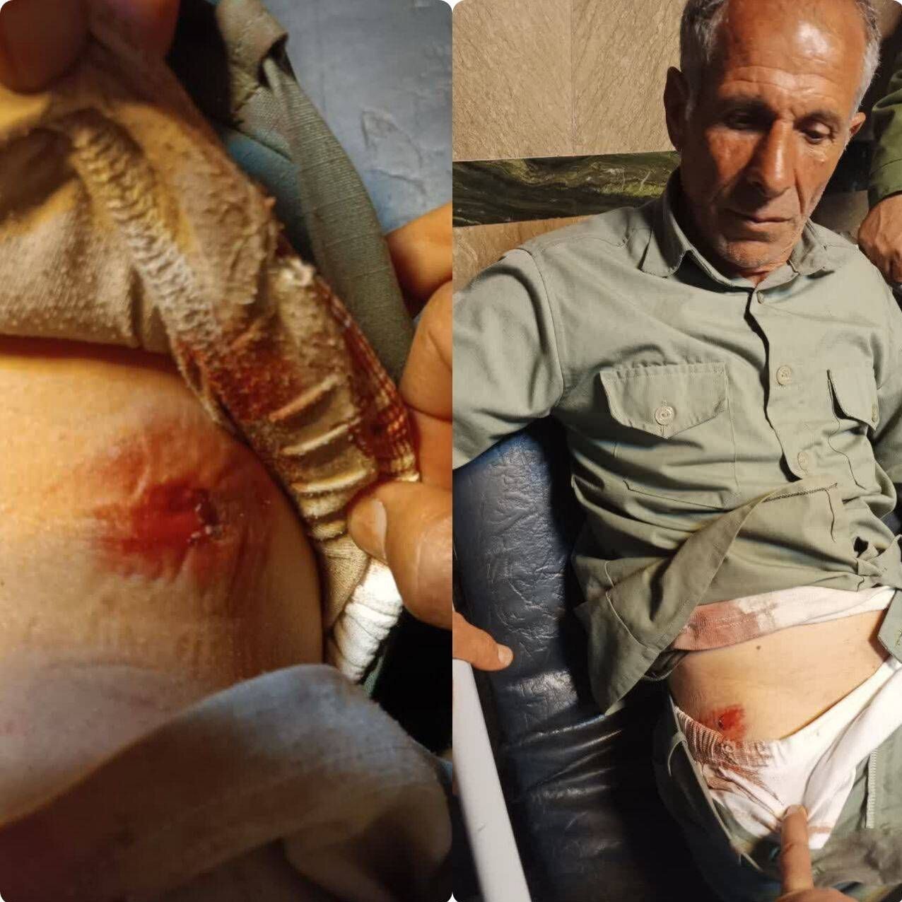 تیر خوردن محیط‌بان در درگیری با شکارچیان