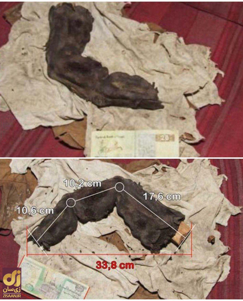 تصویرى از عجیب‌ترین انگشت مومیایى شده جهان!