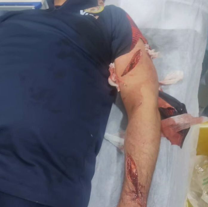 تصویر ۱۶+ از چاقوکشی در فوتبال ایران! تصویر ۱۶+ از چاقوکشی در فوتبال ایران!