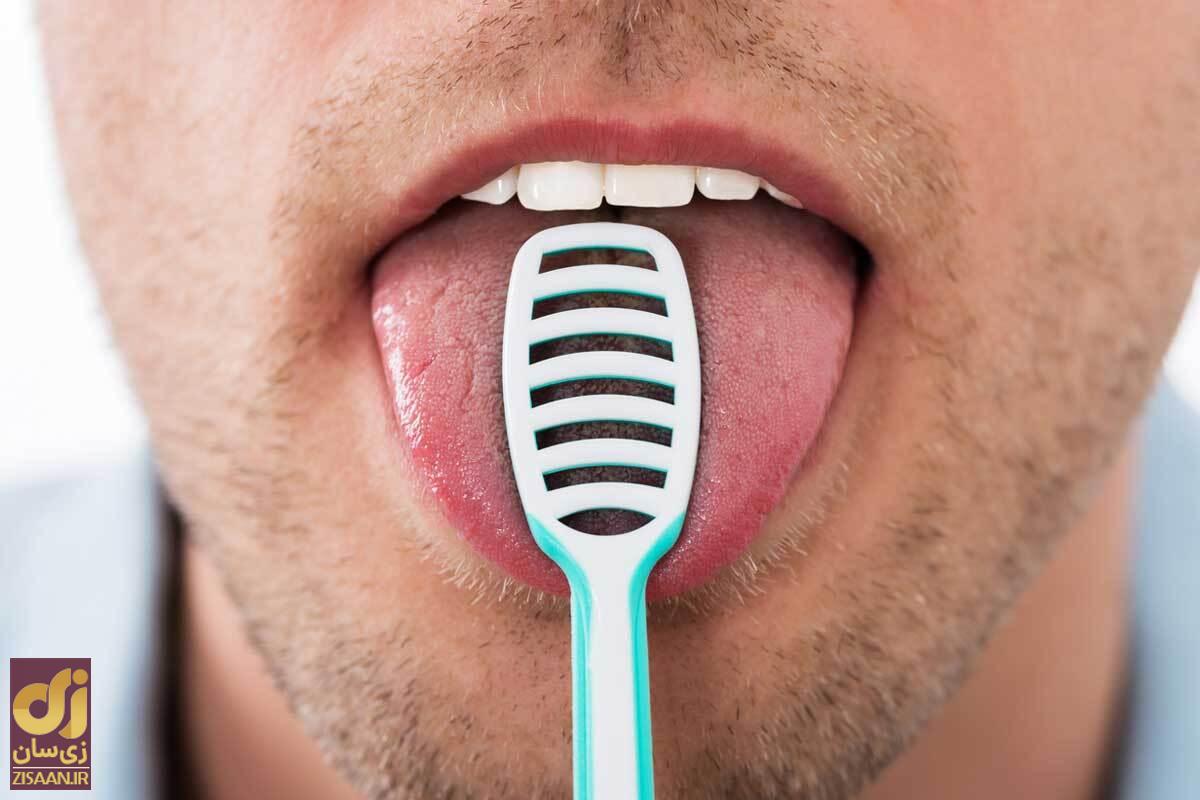 درمان بوی بد صبحگاهی دهان دلیل بوی بد صبحگاهی دهان چیست؟ راههایی برای اینکه صبح دیگر دهانتان بو ندهد!