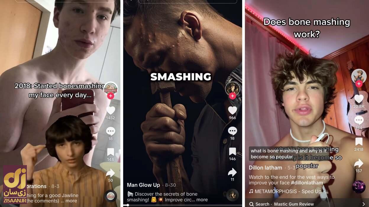 ترند خطرناک تیکتاک که بیش از ۲۷۰ میلیون بار دیده شد؛ عمل زیبایی با چکش! ترند خطرناک تیکتاک که بیش از ۲۷۰ میلیون بار دیده شد؛ عمل زیبایی با چکش!