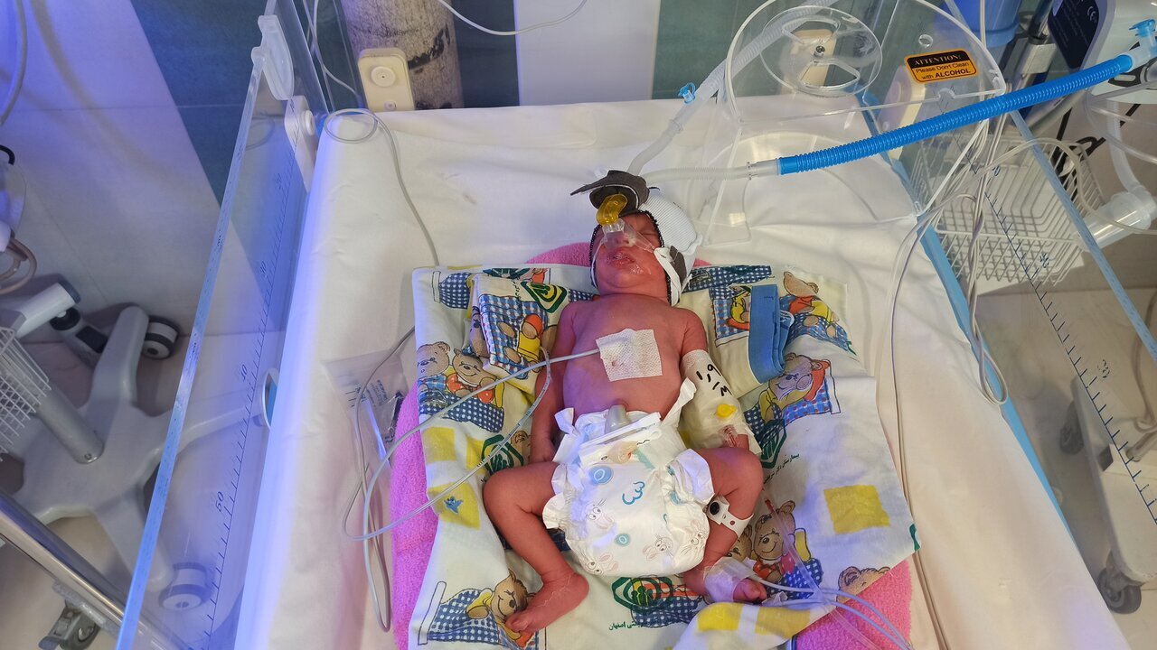 ثبت تولد اولین ۴ قلو‌های اصفهانی در سال ۱۴۰۳ + عکس و اسامی نوزادان