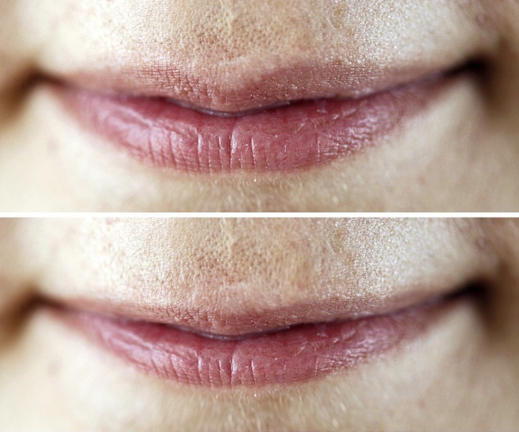 (تصاویر) نشانه‌هایی مهم برای پیر شدن سریع پوست