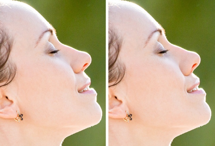 (تصاویر) نشانه‌هایی مهم برای پیر شدن سریع پوست