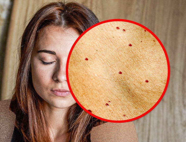 (تصاویر) نشانه‌هایی مهم برای پیر شدن سریع پوست