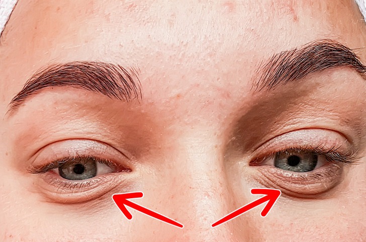 (تصاویر) نشانه‌هایی مهم برای پیر شدن سریع پوست