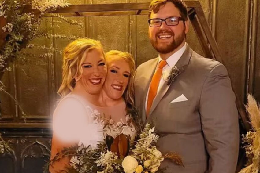 انتشار تصاویری از مراسم ازدواج دوقلو‌های به هم چسبیده با یک سرباز آمریکایی