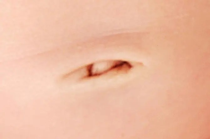 فرم ناف شما درباره شخصیت‌تان چه می‌گوید؟!