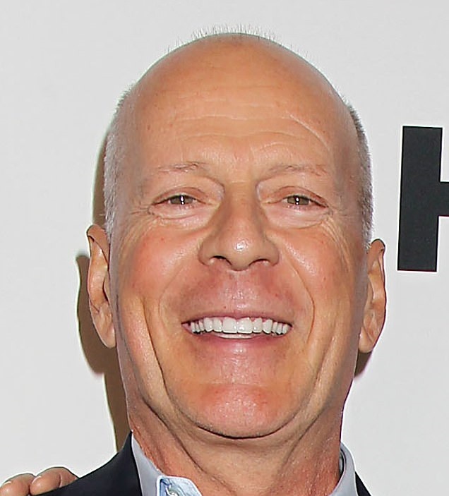 این سلبریتی‌ها وقتی کچل شدند خوشتیپ‌تر و موفق‌تر شدند!