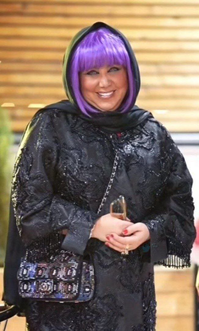 بهنوش بختیاری بازیگر با ظاهری عجیب؛ تغییر باورنکردنی این بازیگر را ببینید!