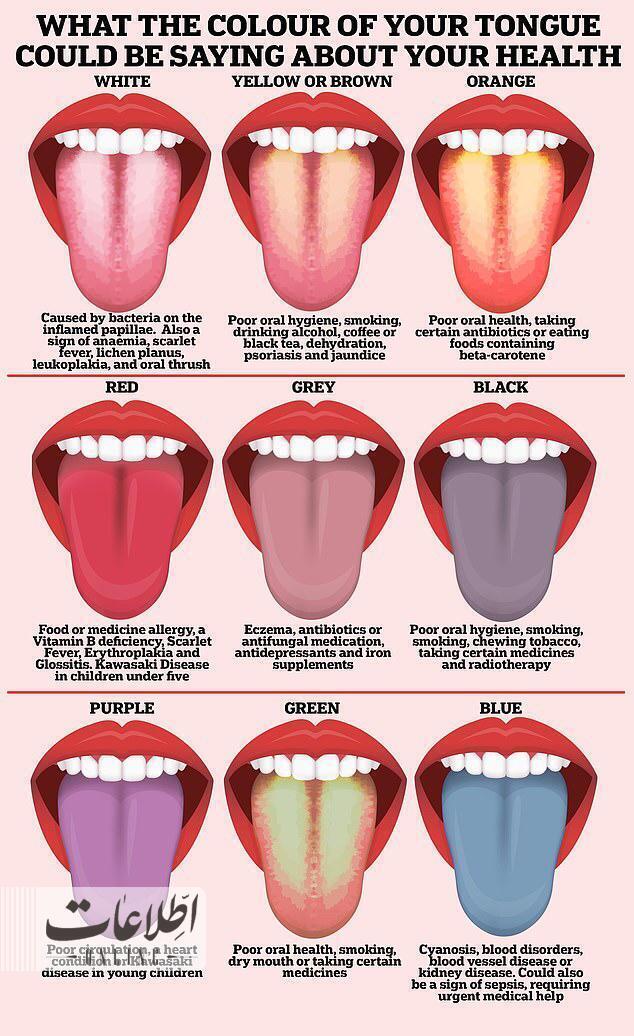 تشخیص وضعیت سلامت از روی رنگ زبان + عکس