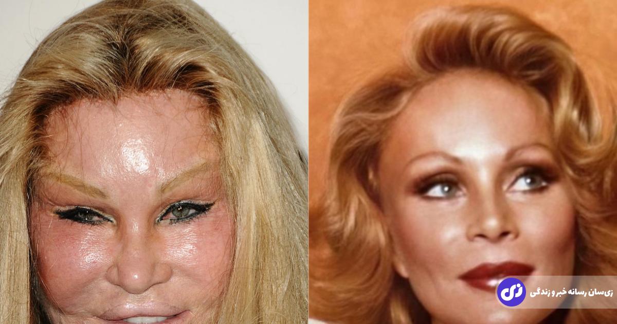 (تصاویر) زن گربه‌ای جهان درگذشت!