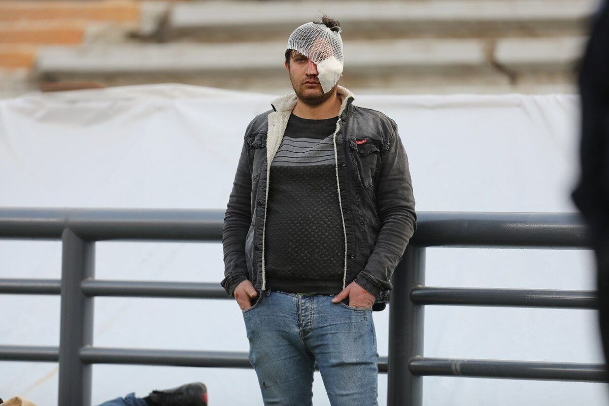 تصاویری تلخ از مصاف پرسپولیس - تراکتور