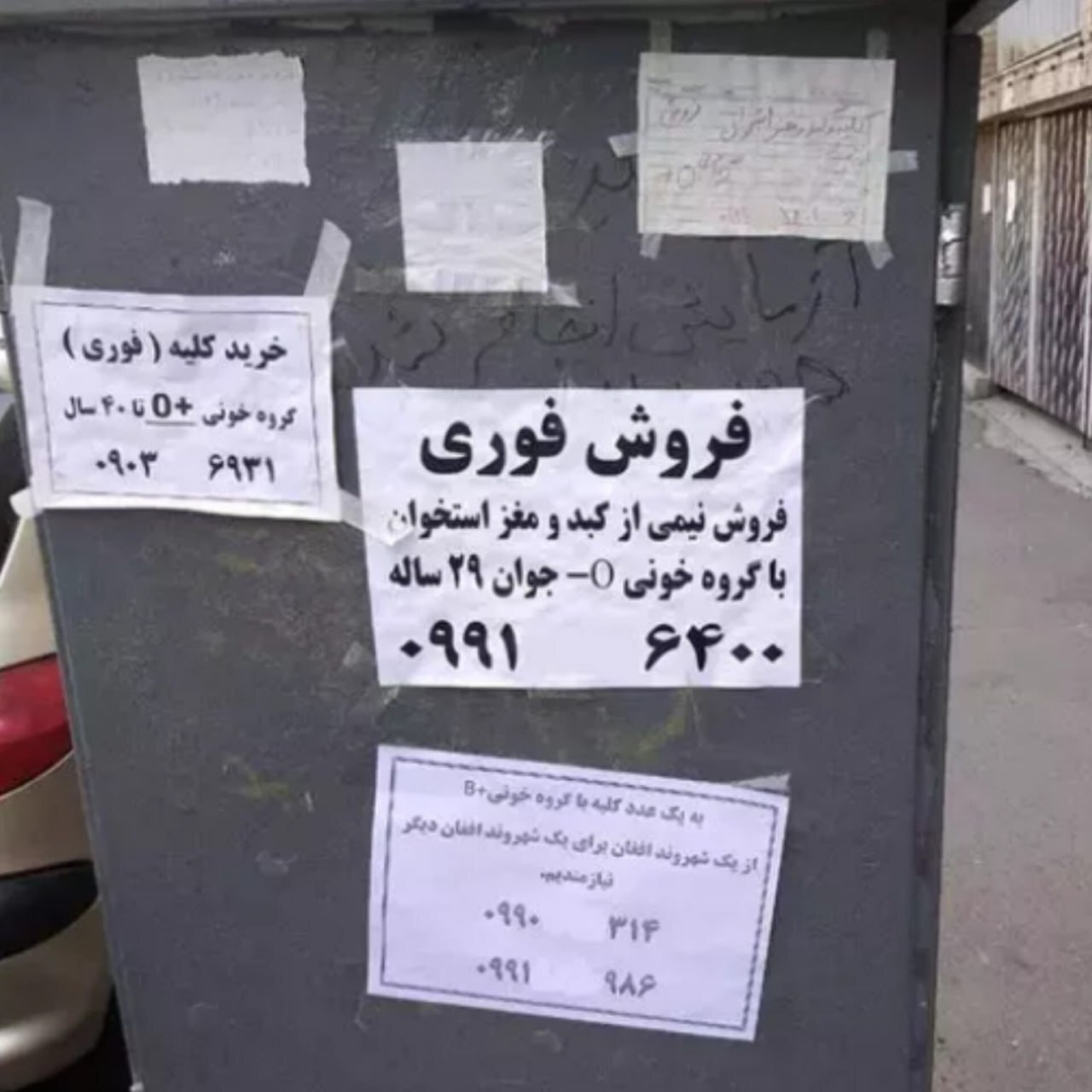 نقل قول معروف «کلیه فروشی» از طرف یک نماینده دوباره جنجالی شد