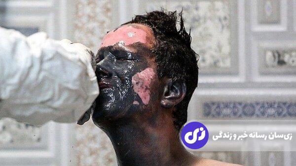 تصاویر +۱۸ و دلخراش از مصدومان چهارشنبه‌سوری ۱۴۰۳ | ده‌ها نفر کشته شدند!