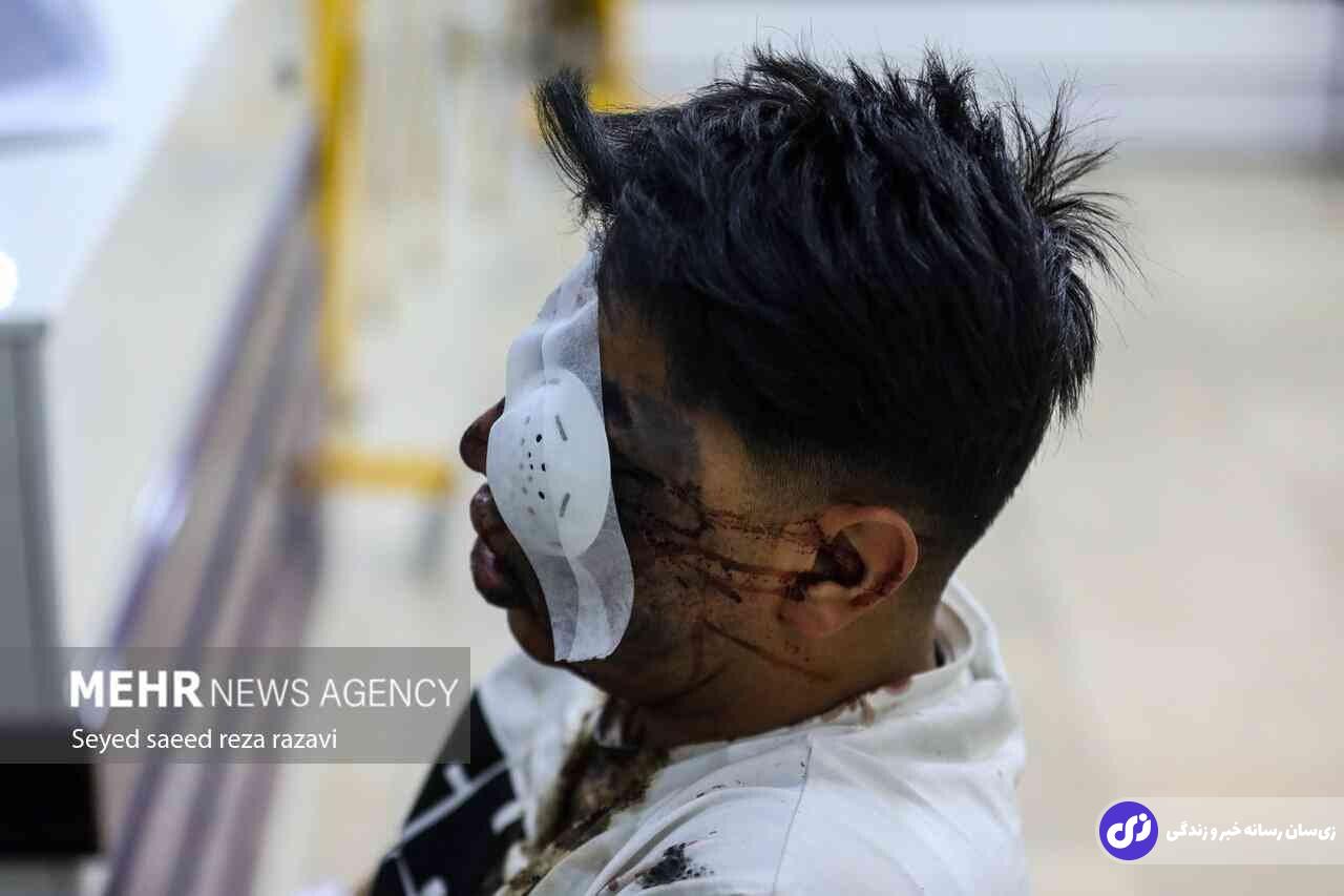 تصاویر +۱۸ و دلخراش از مصدومان چهارشنبه‌سوری ۱۴۰۳ | ده‌ها نفر کشته شدند!