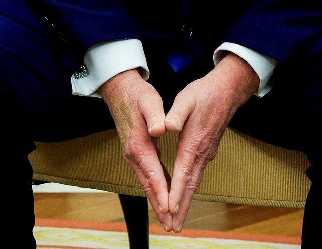 کبودی دست ترامپ بحثبرانگیز شد کبودی دست ترامپ بحثبرانگیز شد