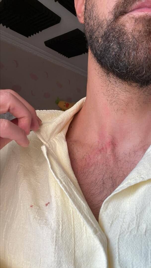 (عکس) حمله خفت‌گیر‌های خشن به مهاجم استقلالی در اتوبان!