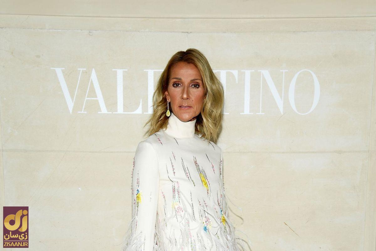 بیماری مرموزی که چهره خواننده مشهور را عوض کرد؛ بیماری «سلن دیون» چیست؟