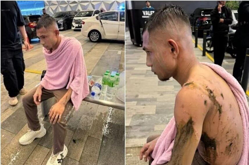 اسیدپاشی به بازیکن ملی پوش + عکس