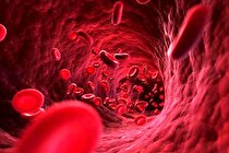 اگر به این هشدارها توجه نکنید کلیه هایتان را از دست می دهید