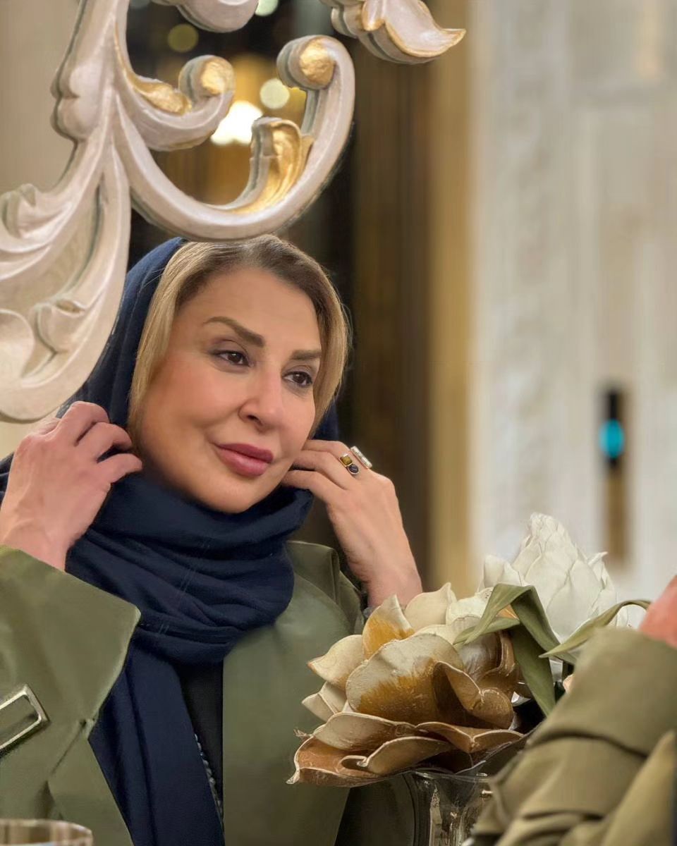 عکسی که عمل زیبایی مرجانه گلچین را لو داد!