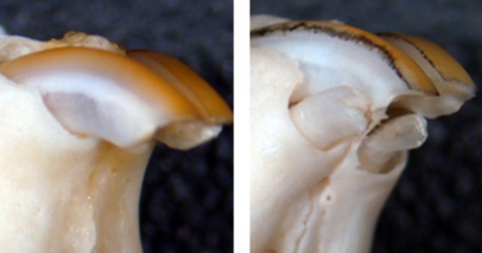 داروی رشد دوباره دندان موفق بود، آزمایش انسانی آغاز شد