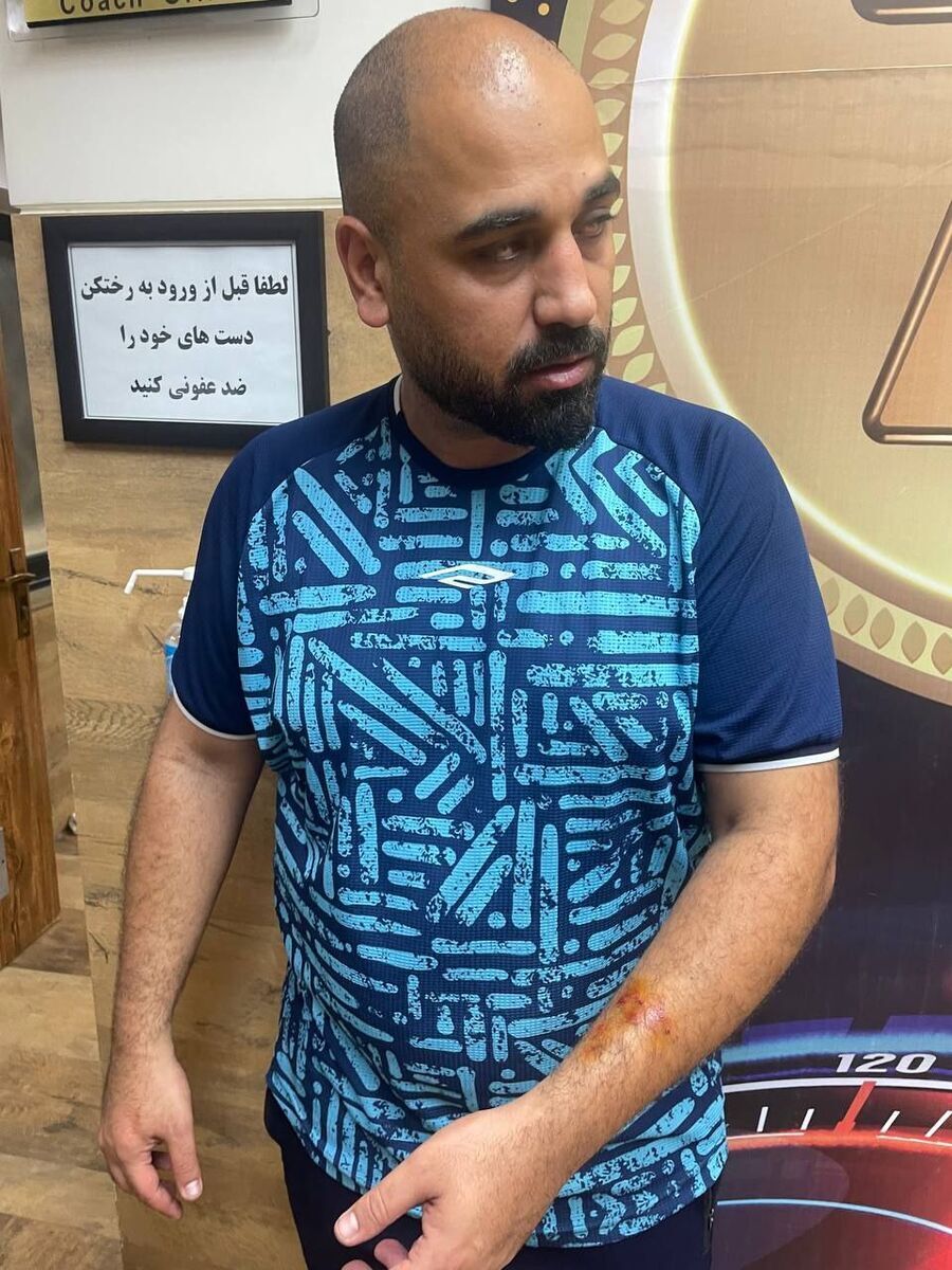 (عکس) وضعیت عجیب بازیکن سپاهان؛ لب سیاوش یزدانی ترکید!