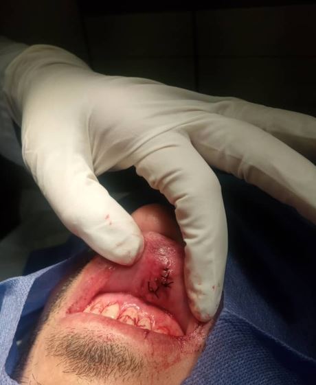 عکس| کار سیاوش یزدانی به اتاق عمل کشید